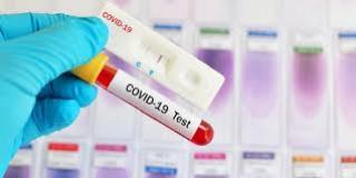 800 Alat Rapid Test Masih Tersedia, Pemko Gencar Cari OTG Covid-19